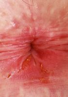 ATK Galleria: Stephanie Gwen (Stephanie Gwen Spreading Outdoors)