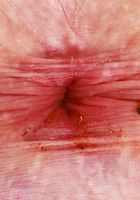 ATK Petites: Stephanie Gwen (Stephanie Gwen Stretching and Spreading)