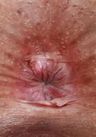 ATK Exotics: Summer Col (Summer Cole Outside Latina Pussy Spreads)