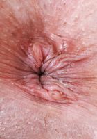 ATK Petites: Summer Col (Summer Col Revealing Bikini)