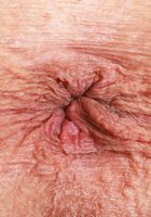 ATK Petites: Summer Vixen (Summer Vixen Outdoor Spreading)