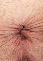 ATK Natural & Hairy: Summer Vixen (Summer lifts her skirt and spreads her long legs.)