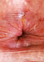 ATK Petites: Sweet Sophia (Sweet Sophia Outdoor Up Skirt)