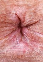 ATK Premium: Violet Viper (Violet Viper puts it out there)