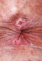 ATK Exotics: Zoey Jpeg (Zoey Jpeg Outdoor Watersports)