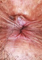 ATK Natural & Hairy: Zoey Jpeg (Zoey Jpeg Sexy Spreading)